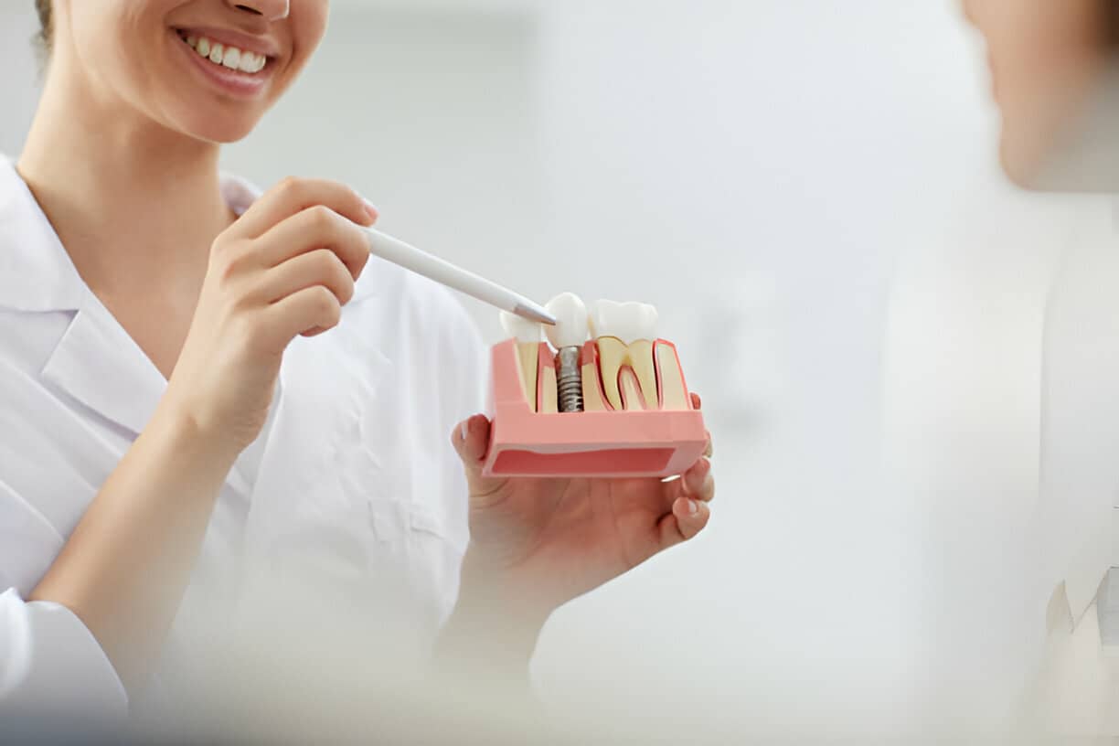 The Healing Process After Dental Implants